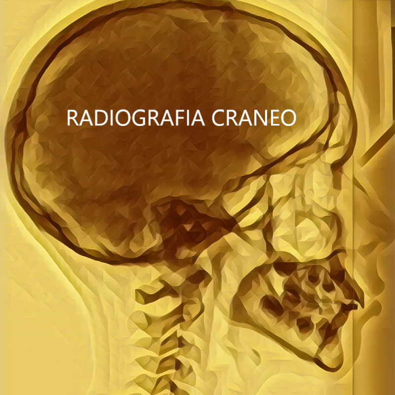 radiografia
